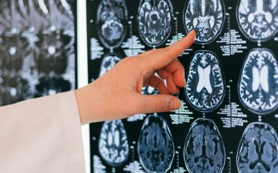 Alzheimer: România, pionieră în tratamente medicale unice