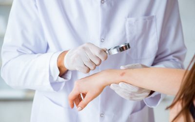 De ce apare și cum o tratezi: Ghid practic pentru orice situație