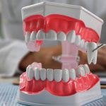 Extracție vs. Fără extracție în ortodonție: Ce spun medicii și de ce?