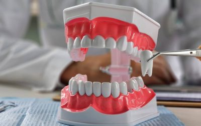 Extracție vs. Fără extracție în ortodonție: Ce spun medicii și de ce?
