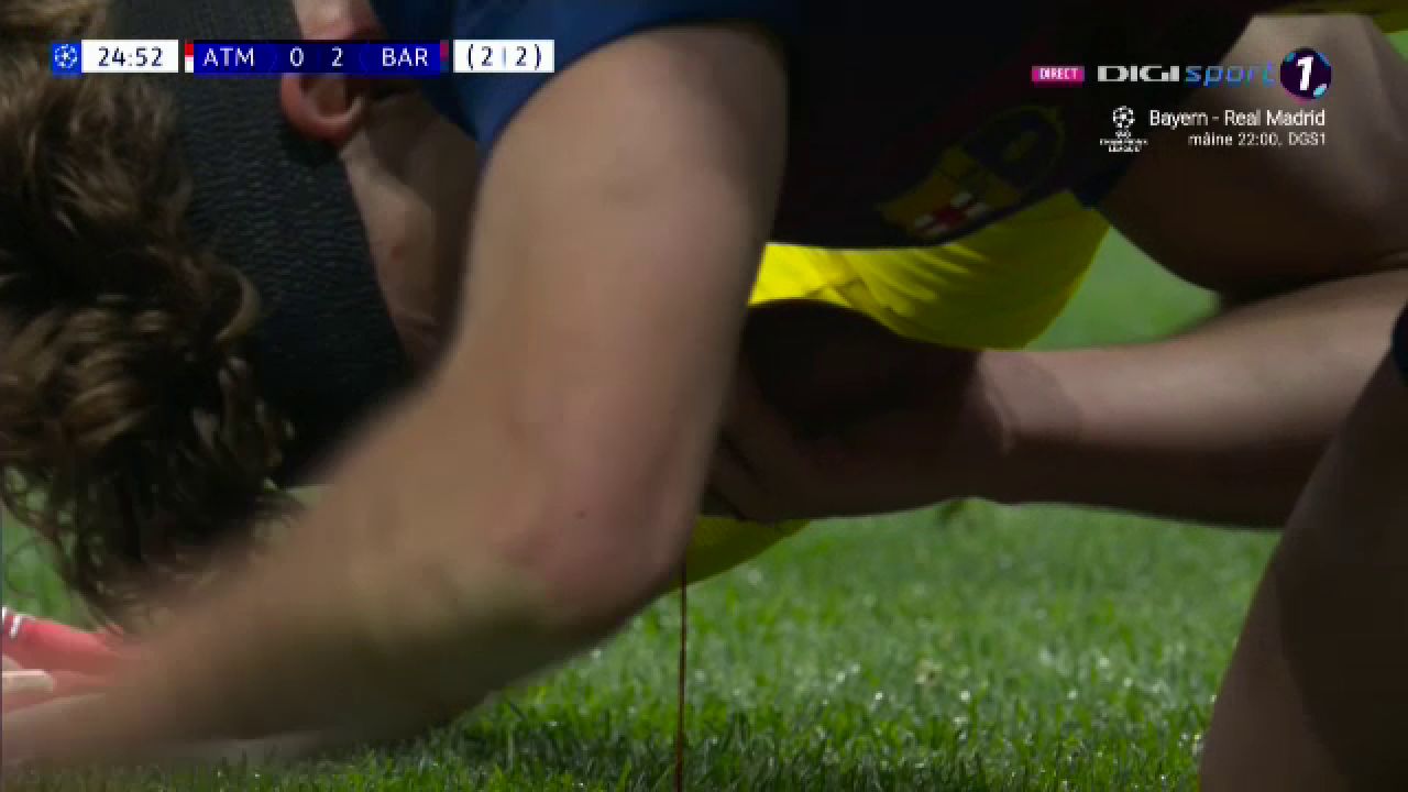 Accidentare TERIBILĂ în Atletico – Barcelona: Fermin Lopez, zdrobit de sânge