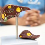 Boala silențioasă a tinerilor: Stilul de viață modern, un dușman ascuns