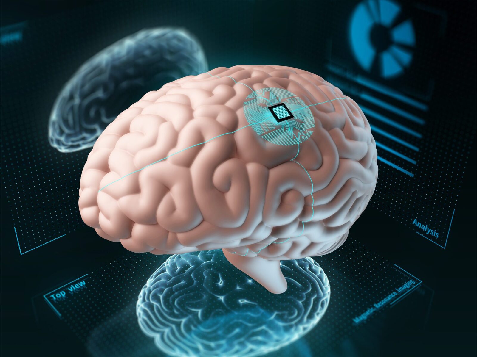 Implant cerebral revoluționar, mai mic decât un bob de sare, deschide noi orizonturi în cercetarea neuronală Cercetătorii de la Universitatea Cornell au dezvoltat un implant neural extrem de mic, capabil să monitorizeze și să transmită wireless activitatea cerebrală