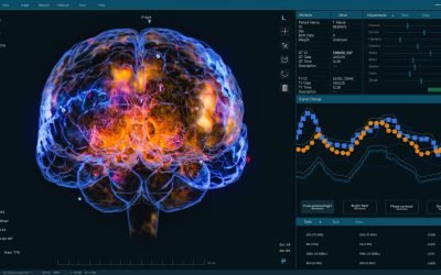 Cercetare: Stresul, asociat cu dependența, confirmă studiul