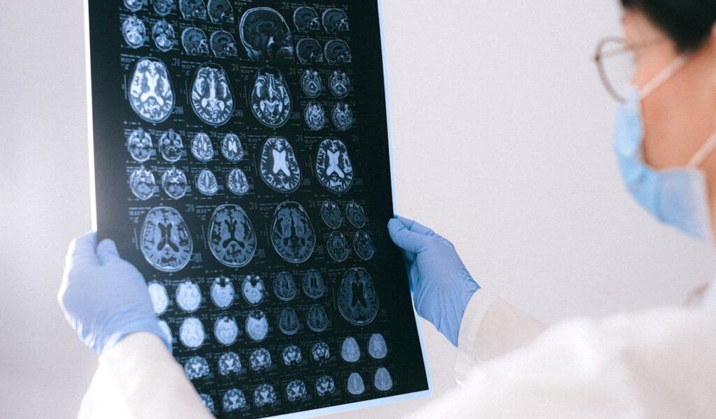 Primul semn de declin cognitiv: Neurologii avertizează, nu are legătură cu memoria