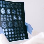 Primul semn de declin cognitiv: Neurologii avertizează, nu are legătură cu memoria
