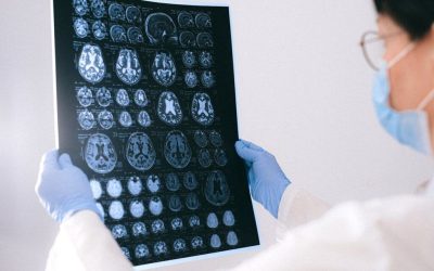 Primul semn de declin cognitiv: Neurologii avertizează, nu are legătură cu memoria