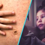 Rujeolă, gripă, vaccinare: Dr. Alexiu despre dramele din România