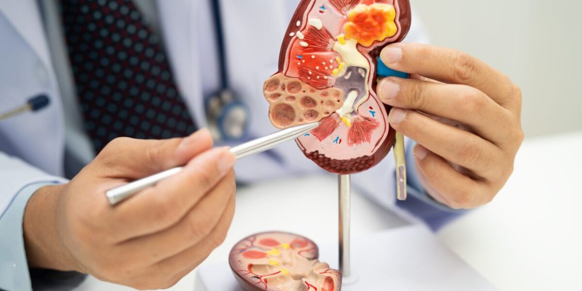 Ce dezvăluie analizele medicale despre sănătatea rinichilor