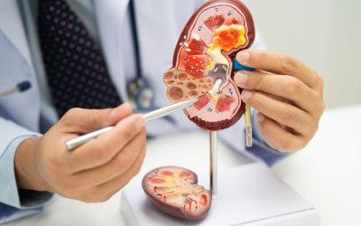 Ce dezvăluie analizele medicale despre sănătatea rinichilor