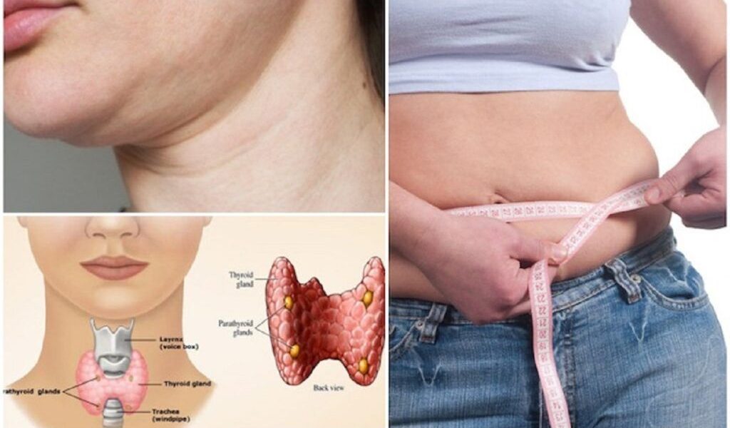 Milioane de românce luptă cu kilogramele în plus din cauza problemelor cu tiroida, iar alimentația devine un factor crucial în gestionarea afecțiunii