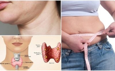 Milioane de românce luptă cu kilogramele în plus din cauza problemelor cu tiroida, iar alimentația devine un factor crucial în gestionarea afecțiunii