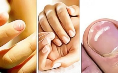 Unghiile, oglinda stării de sănătate: ce afecțiuni pot indica schimbările la nivelul lor Modificările observate la nivelul unghiilor pot reprezenta semnale de alarmă importante cu privire la starea de sănătate, avertizând asupra unor afecțiuni serioase