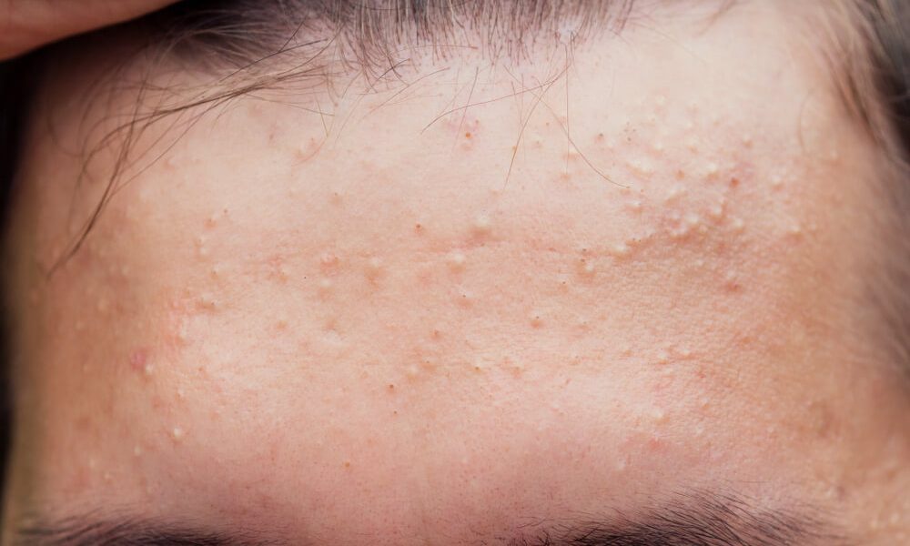 Protocol (P) în 3 pași simpli. Vezi ce trebuie să faci!