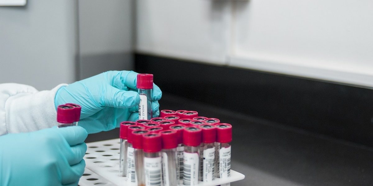 Pacient cu Hantavirus la Arad, fără istoric de călătorii în afara României
