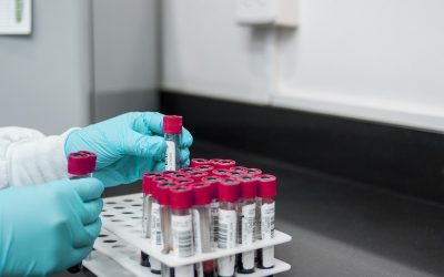 Pacient cu Hantavirus la Arad, fără istoric de călătorii în afara României