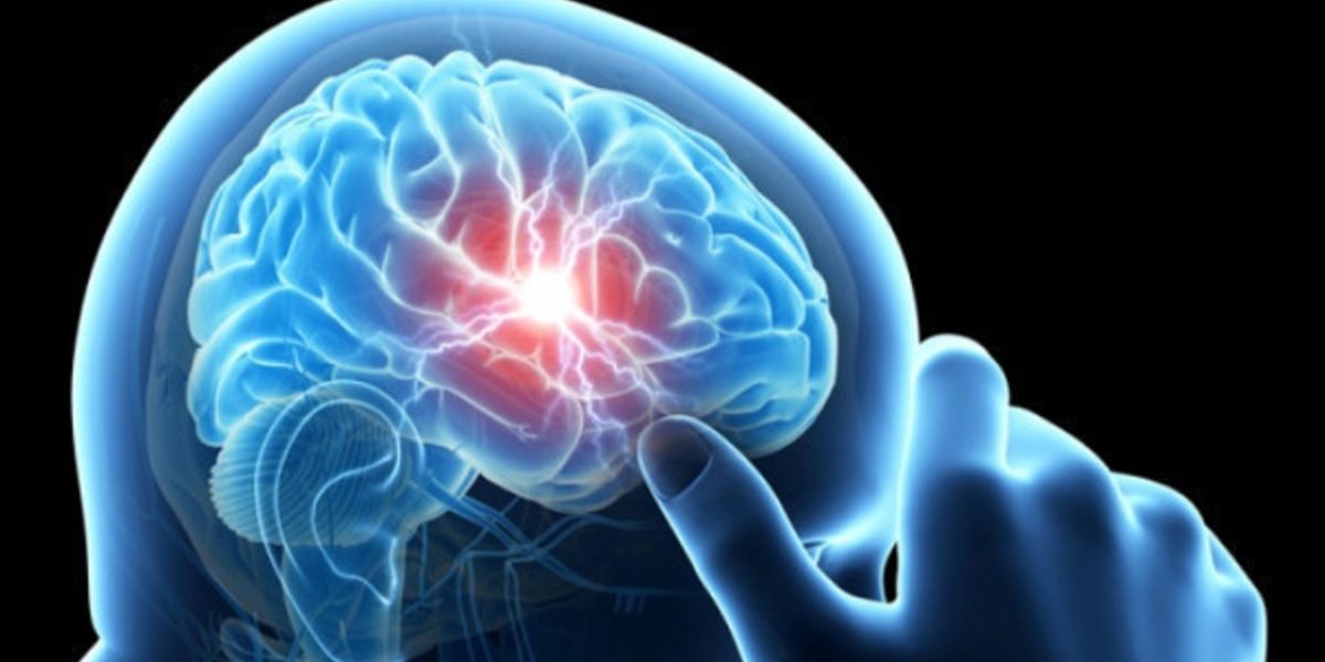 Grupă de sânge: Risc crescut de AVC sub 60 de ani