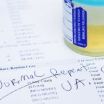 Test Urină: Depistează 9 din 10 Caze de Cancer Vezical
