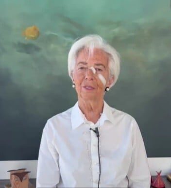 Lagarde, pansamente pe față: „Micul cancer de piele, nu kick-boxing”